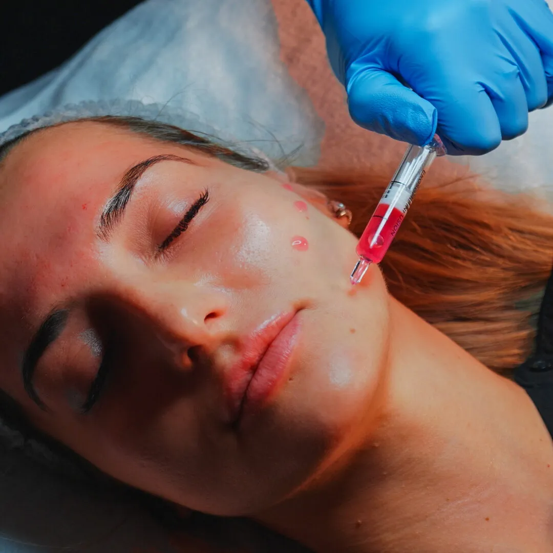 Microneedling / serum treatment